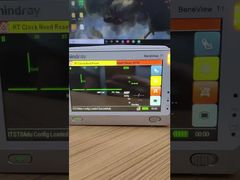 Neden Mindray BeneView T1 Hasta Monitörünü Seçtiğinizi Görün Ön Kapaklı LCD Ekran