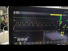 Mindray AG Modülü AG ve O2 Modülü MMS Modülü PN 115-023943-00 Demosunu Görüntüleyin