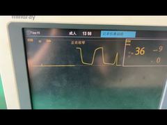 Daha Yakından Bakış: 9200-10-10530 Yetişkin Pediatrik Anestezi Gaz Modülü için Mindray Su Tutucu